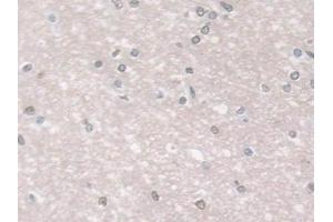 Detection of GPX3 in Human Cerebrum Tissue using Polyclonal Antibody to Glutathione Peroxidase 3, Plasma (GPX3) (GPX3 antibody  (AA 21-72))