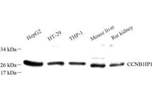 Western blot analysis of Ccnb1ip1 (ABIN7073614) at dilution of 1: 50 (CCNB1IP1 antibody)
