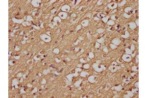 Immunohistochemistry of paraffin-embedded human brain tissue using ABIN7144489 at dilution of 1:200 (APP antibody)