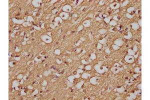 Immunohistochemistry of paraffin-embedded human brain tissue using ABIN7144489 at dilution of 1:200 (APP antibody)