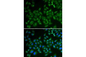 Immunofluorescence analysis of HeLa cells using SMPD1 antibody. (SMPD1 antibody  (AA 70-340))