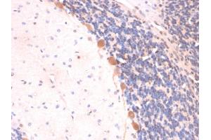 Immunohistochemistry (IHC) image for anti-ADP-Ribosylation Factor 1 (ARF1) antibody (ABIN6939846)