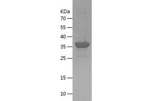 Western Blotting (WB) image for CTF18, Chromosome Transmission Fidelity Factor 18 Homolog (CHTF18) (AA 71-301) protein (His-IF2DI Tag) (ABIN7283743) (CTF18 Protein (AA 71-301) (His-IF2DI Tag))