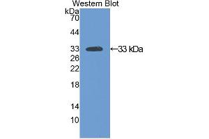 Western blot analysis of recombinant Rat SIRT2.