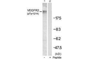 Western blot analysis of extracts from SKOV3 cells using VEGFR2(Phospho-Tyr1214) Antibody(Lane 1) and the same antibody preincubated with blocking peptide(Lane2). (VEGFR2/CD309 antibody  (pTyr1214))