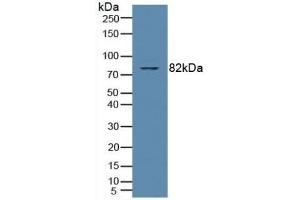 Detection of PKCq in Human Jurkat Cells using Polyclonal Antibody to Protein Kinase C Theta (PKCq) (PKC theta antibody  (AA 380-634))