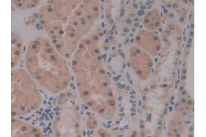 Figure. (PKIB antibody  (AA 8-76))