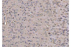 IHC analysis of ARFGAP1 using anti-ARFGAP1 antibody (ABIN4886474). (ARFGAP1 antibody  (AA 1-183))
