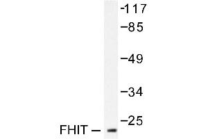 Image no. 2 for anti-Fragile Histidine Triad (FHIT) antibody (ABIN265419)