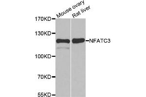 Western blot analysis of extracts of various cell lines, using NFATC3 antibody. (NFATC3 antibody)