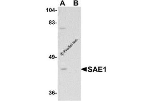 Western Blotting (WB) image for anti-SUMO1 Activating Enzyme Subunit 1 (SAE1) (C-Term) antibody (ABIN1030635) (SAE1 antibody  (C-Term))