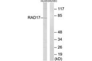 Western blot analysis of extracts from HuvEc cells, using RAD17 (Ab-645) Antibody. (RAD17 antibody  (AA 621-670))