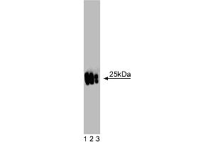 Western blot analysis of MnSOD on a mouse kidney lysate. (SOD2 antibody  (AA 114-220))