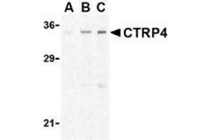 Western blot analysis of CTRP4 in rat brain cell lysate with AP30253PU-N CTRP4 antibody at (A) 1, (B) 2, and (C) 4 μg/ml. (C1QTNF4 antibody  (N-Term))