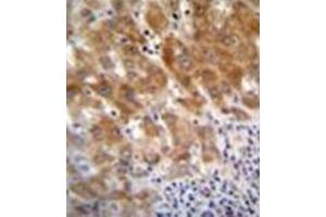 Formalin fixed and paraffin embedded human liver tissue reacted with Fumarylacetoacetase Antibody (N-term) Cat. (FAH antibody  (N-Term))