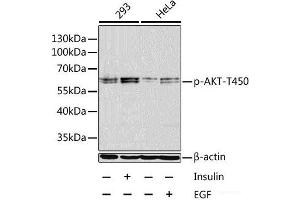 Western blot analysis of extracts of 293 and HeLa cells using Phospho-AKT(T450) Polyclonal Antibody at dilution of 1:1000. (AKT1 antibody  (pThr450))