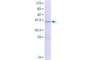 Image no. 1 for Calcium and Integrin Binding Protein 4 (CIB4) (AA 1-185) protein (GST tag) (ABIN1349470) (CIB4 Protein (AA 1-185) (GST tag))