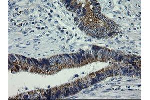 Image no. 2 for anti-Armadillo Repeat Containing 1 (ARMC1) antibody (ABIN1496727) (ARMC1 antibody)