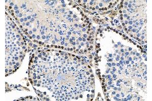 ABIN6259049 and ABIN6273584 at 1/100 staining Mouse testis tissue by IHC-P.