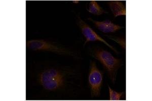Image no. 1 for anti-Cofilin 1 (CFL1) (Tyr88) antibody (ABIN319381) (Cofilin antibody  (Tyr88))