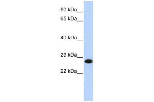 WB Suggested Anti-PSMA2 Antibody Titration: 0. (PSMA2 antibody  (N-Term))