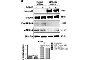 Western Blotting (WB) image for anti-SMAD, Mothers Against DPP Homolog 3 (SMAD3) (pSer423), (pSer425) antibody (ABIN129675)