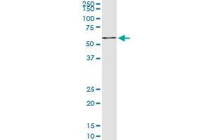 NR4A2 monoclonal antibody (M07), clone 4A6 Western Blot analysis of NR4A2 expression in Hela NE (NR4A2 antibody  (AA 71-170))