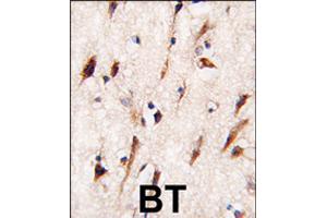 Formalin-fixed and paraffin-embedded human brain tissue reacted with MOBKL1A polyclonal antibody  , which was peroxidase-conjugated to the secondary antibody, followed by DAB staining . (MOBKL1A antibody  (C-Term))