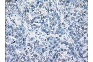 Image no. 2 for anti-Fc Fragment of IgG, Low Affinity IIa, Receptor (CD32) (FCGR2A) antibody (ABIN1497259) (FCGR2A antibody)