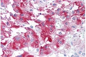 Human Adrenal Medulla (formalin-fixed, paraffin-embedded) stained with USP20 antibody ABIN213604 at 10 ug/ml followed by biotinylated goat anti-rabbit IgG secondary antibody ABIN481713, alkaline phosphatase-streptavidin and chromogen. (USP20 antibody  (Internal Region))