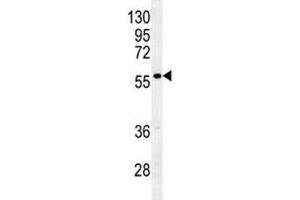 Glypican 3 antibody western blot analysis in mouse stomach tissue lysate (Glypican 3 antibody  (AA 21-50))