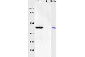 L1 mouse brain lysates L2 human colon carcinoma lysates probed with Anti - phospho-JNK1/2/3 (Thr183+Tyr185) Polyclonal Antibody, Unconjugated (ABIN732368) at 1:200 in 4 °C. (JNK antibody  (pThr183, pTyr185))
