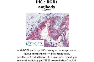 Image no. 1 for anti-Receptor Tyrosine Kinase-Like Orphan Receptor 1 (ROR1) (C-Term) antibody (ABIN1738934) (ROR1 antibody  (C-Term))