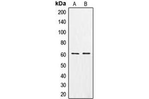 Western blot analysis of CSGALNACT1 expression in MCF7 (A), K562 (B) whole cell lysates. (CSGALNACT1 antibody  (Center))
