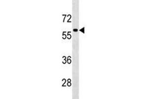 TFEB antibody western blot analysis in HepG2 lysate. (TFEB antibody  (AA 271-300))