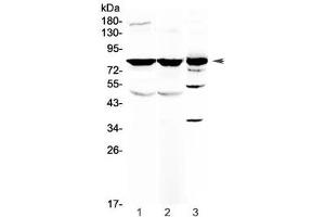 Western blot testing of 1) rat brain, 2) mouse brain and 3) human HepG2 antibody at 0. (NSF antibody)