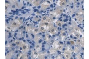 Detection of PCYOX1 in Mouse Stomach Tissue using Polyclonal Antibody to Prenylcysteine Oxidase 1 (PCYOX1) (PCYOX1 antibody  (AA 249-505))