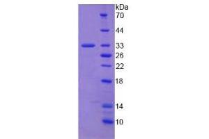 Image no. 1 for Collagen, Type I, alpha 2 (COL1A2) (AA 1103-1366) protein (His tag) (ABIN6236613)