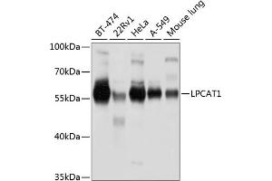 Western blot analysis of extracts of various cell lines, using LPC antibody (ABIN6130983, ABIN6143295, ABIN6143296 and ABIN6220819) at 1:1000 dilution. (LPCAT1 antibody  (AA 325-534))