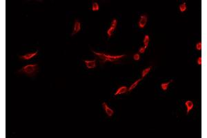 ABIN6277934 staining HepG2? (Nestin antibody  (C-Term))