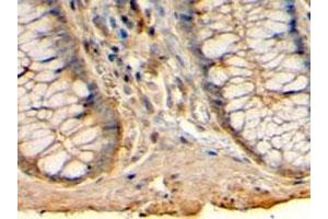 HRH1 polyclonal antibody (Cat # PAB6855, 4 ug/mL) staining of paraffin embedded human colon.