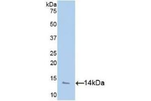 Detection of Recombinant PF4, Human using Polyclonal Antibody to Platelet Factor 4 (PF4) (PF4 antibody  (AA 31-101))