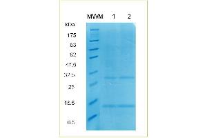 SDS-PAGE analysis of recombinant TGF-β2. (TGFB2 Protein (His tag))