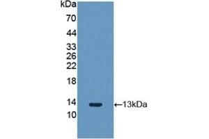 Detection of Recombinant FGF2, Rabbit using Polyclonal Antibody to Fibroblast Growth Factor 2, Basic (FGF2)