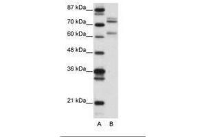 Image no. 1 for anti-GATA Zinc Finger Domain Containing 2B (GATAD2B) (AA 61-110) antibody (ABIN6736149) (GATAD2B antibody  (AA 61-110))