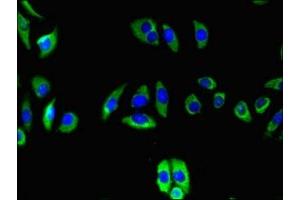 Immunofluorescent analysis of A549 cells using ABIN7173833 at dilution of 1:100 and Alexa Fluor 488-congugated AffiniPure Goat Anti-Rabbit IgG(H+L)