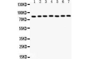 Anti- MAD1 Picoband antibody, Western blotting All lanes: Anti MAD1  at 0. (MAD1L1 antibody  (AA 362-632))