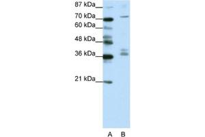 Western Blotting (WB) image for anti-A Kinase (PRKA) Anchor Protein (Yotiao) 9 (AKAP9) antibody (ABIN2461765)