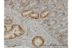 Immunoperoxidase of monoclonal antibody to TLN1 on formalin-fixed paraffin-embedded human small Intestine. (TLN1 antibody  (AA 1052-1149))