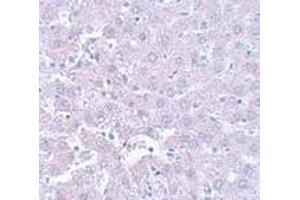 Immunohistochemistry of CALHM1 in rat liver tissue with CALHM1 antibody at 5 μg/ml. (CALHM1 antibody  (N-Term))